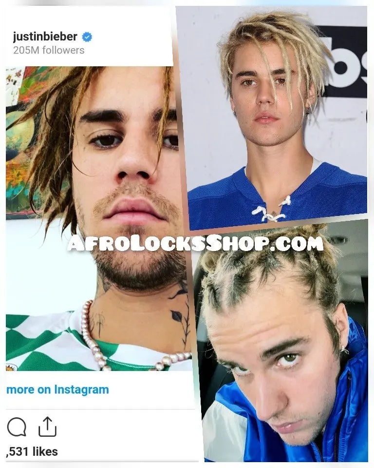 Faire des locks quand on est blanc c’est irrespectueux ? Est-ce que les blancs peuvent avoir des dreadlocks ? Est-ce de l’appropriation culturelle ?